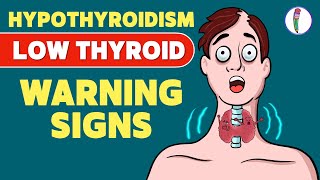 Signs that you have a Low Thyroid Level  Hypothyroidism  Signs amp Symptoms  Thyroid disease [upl. by Ailuig35]