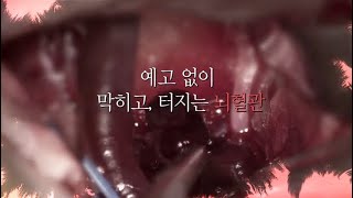 뇌졸중 초기 진단하는 10초 테스트 shorts [upl. by Kilby]