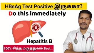 HBsAg Positive what to do next HBsAg hepatitis hbv drmerish hbsagtest [upl. by Gnivri74]