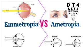 What Is EmmetropiaEmmetropiya kya hai What Is Ametropia In Hindi [upl. by Candie]