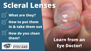 Scleral Lenses What They Are amp How to Use Them [upl. by Eserahc]