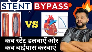 Stent Vs Bypass Surgery In Hindi  Heart Attack [upl. by Reffotsirk]