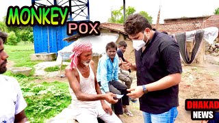 MONKEYPOX  HARSH RAJPUT [upl. by Eiroc]