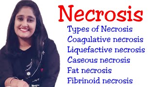 Necrosis Types of Necrosis Coagulative Liquefactive Caseous Fat Fibrinoid Necrosis [upl. by Cornish]