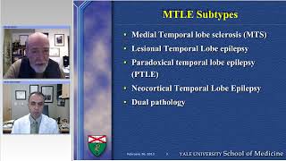 Medial Temporal Lobe Epilepsy Evaluation Preview [upl. by Neyugn]