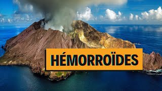 HEMORROIDES Tout savoir en 5 minutes [upl. by Tim619]