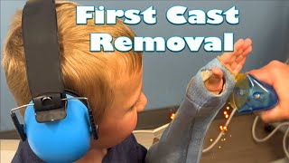 My Sons First Cast Removal  You Wont Believe His Reaction Must Watch [upl. by Teragram]