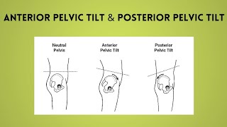 Anterior pelvic tiltPosterior pelvic tiltkinesiology lectures in UrduPhysio class [upl. by Aisiat92]