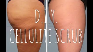 Coffee Body Scrub  How to get rid of your CELLULITE at home NATURALLY  ItsAllAboutSaw [upl. by Nahgeem]