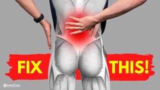 How to Fix Lower Back Strain Pain in 30 SECONDS [upl. by Feldman]