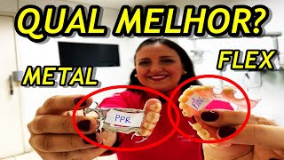 Prótese FLEXÍVEL ou METÁLICA qual é a melhor Vantagens e Desvantagens [upl. by Areip294]