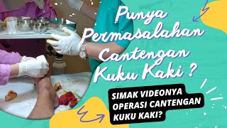 OPERASI CANTENGAN KUKU KAKI [upl. by Retxed66]