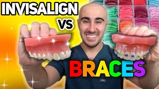 Invisalign Pros and Cons [upl. by Segroeg]