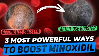 Minoxidil Boosters  3 Most Powerful Ways to Make Minoxidil MORE Powerful [upl. by Gareri]