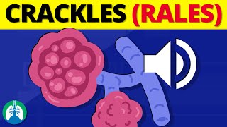 Crackles Rales  Medical Definition and Explanation [upl. by Vance289]