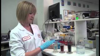 Preparing and Staining Blood Film [upl. by Aicyle]