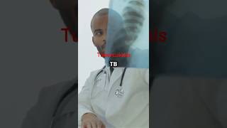 Understanding Tuberculosis Symptoms Diagnosis and Treatment tb disease shorts trending facts [upl. by Bean]