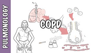 Understanding COPD  Chronic obstructive pulmonary disease cause pathophysiology and treatment [upl. by Willock]