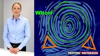 Fingerprint Patterns and Characteristics [upl. by Wallford211]