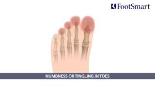 Forefoot Problems symptoms treatment prevention [upl. by Kannav]