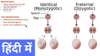 Types of Twins in Hindi [upl. by Muns]