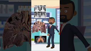 About Tuberculosis disease cartoon ai animation tb neet hindi motivation fitness pharmacy [upl. by Sapphira]