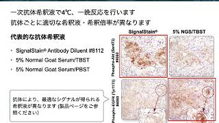 免疫組織化学染色 IHC の基礎：第3回 免疫染色 [upl. by Brittain]