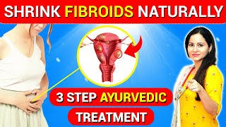 FIBROIDS Part 2 Types of fibroids [upl. by Gare]