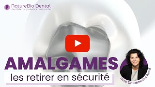 La dépose sécurisée des amalgames [upl. by Nita]