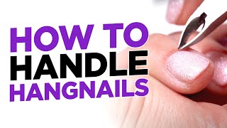 How to Safely Handle Hangnails [upl. by Nuri661]