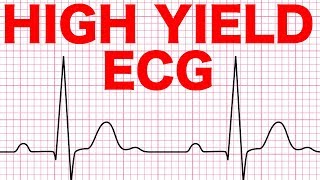 Electrocardiograms ECG Made Easy [upl. by Osicnarf717]