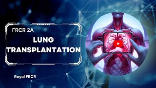 10  Chest Imaging for FRCR [upl. by Madella684]