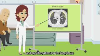 What is an HRCT scan [upl. by Lardner]