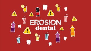 Erosión dental [upl. by Airrat]