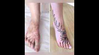 20 amazing tattoo designs to cover up scarbirthmarks [upl. by Radack192]