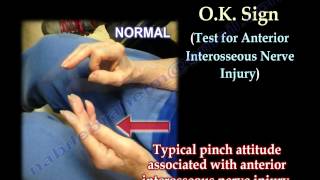 Nerve Injury Positions Of The Hand  Everything You Need To Know  Dr Nabil Ebraheim [upl. by Oilisab855]