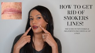 How To Get Rid of Smokers Lines Lip Wrinkles and Vertical Lip lines 👄 [upl. by Towney]