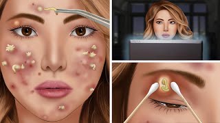 ASMR eye treatment animation  eye pimple  Acne Removal [upl. by Arocal]