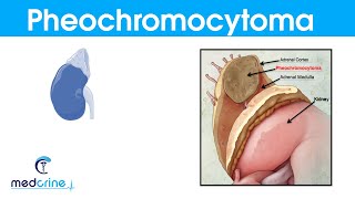 Upper Gastrointestinal GI Pathology  Introduction to Systemic Pathology [upl. by Tsiuqram]