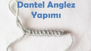 Dantel Anglez Yapımı [upl. by Dnalyag]