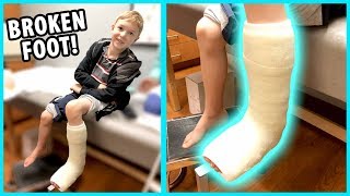 Getting a Cast Jacob Broke His Foot  Part 2 [upl. by Vina]