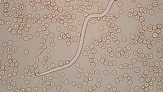 Dirofilaria immitis  microfilaria 400x [upl. by Carlotta]