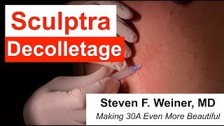 Sculptra Decolletage Injection  Dr Steven F Weiner Destin FL [upl. by Dott]