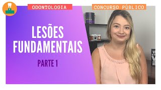 LESÕES FUNDAMENTAIS NA ODONTOLOGIA  PARTE 1 CONCURSO PÚBLICO [upl. by Greff]