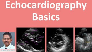 Echocardiography Basics [upl. by Nyleak]