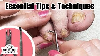 Easy Pedicure Tutorial Dementia Foot amp Nail Care Pedicure nails satisfying [upl. by Llenod]