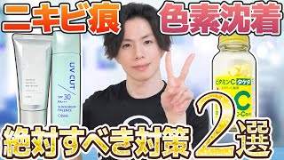 【ニキビ痕（にきびあと）・色素沈着】治したいなら絶対するべき２つの対策【日焼け止め＆ビタミンC】 [upl. by Cirillo]