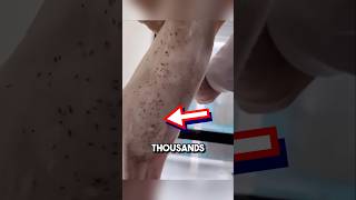 Extremely satisfying bug removal 😱 shorts oddlysatisfying [upl. by Lough]