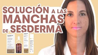 TRATAMIENTO ANTIMANCHAS Sesderma rostro libre de manchas solares I Al detalle [upl. by Lyrej]