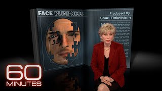 From the 60 Minutes Archive Face Blindness [upl. by Imailiv]